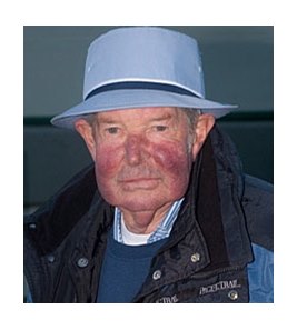 Dennis Patterson